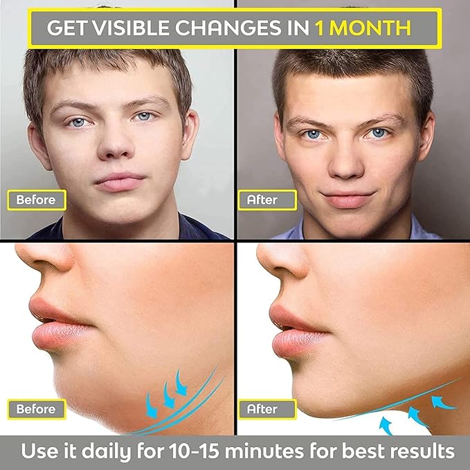 Jawline Exerciser Tool for Men & Women – Face & Neck Toning Shaper to Define Jawline, Slim & Sculpt, Reduce Stress & Cravings – Anti-Aging Double Chin Workout Device