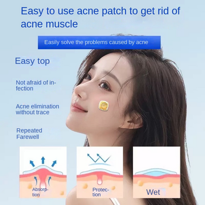 Electronic Acne Patches
